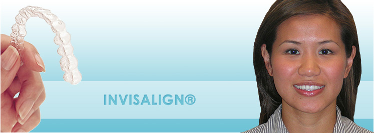 invisalign retainer